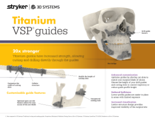 VSP Titanium and Nylon guides flyer