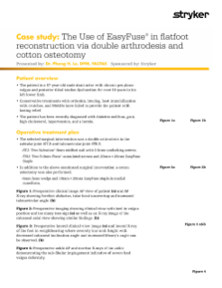 Use of EasyFuse in flatfoot reconstruction via double arthrodesis and