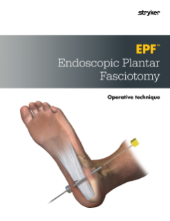 EPF Endoscopic Plantar Fasciotomy | Operative Technique