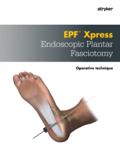 EPF Xpress Endoscopic Plantar Fasciotomy | Operative Technique
