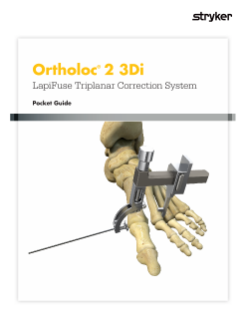 Ortholoc 2 Lapifuse | Pocket Guide