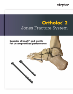 Ortholoc 2 Jones Fracture | Brochure