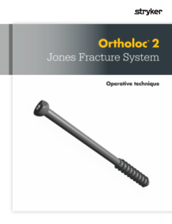 Ortholoc 2 Jones Fracture | Operative Technique