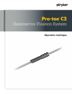 Pro-toe C2 Hammertoe FIxation System | Operative Technique