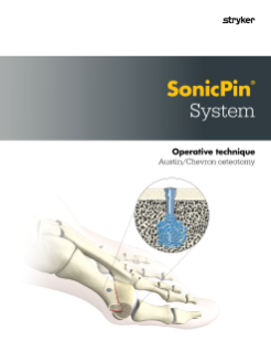 SonicPin | Operative Technique