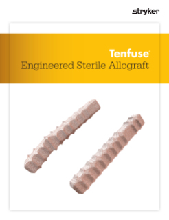 Tenfuse PIP Sterile Allograft | Brochure