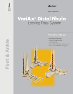 VariAx 2 Distal Fibula | Operative Technique