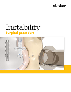 Instability procedural guide