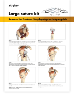 Reverse for fracture step-by-step guide using the large suture kit