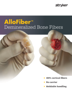 AlloFiber Sell Sheet